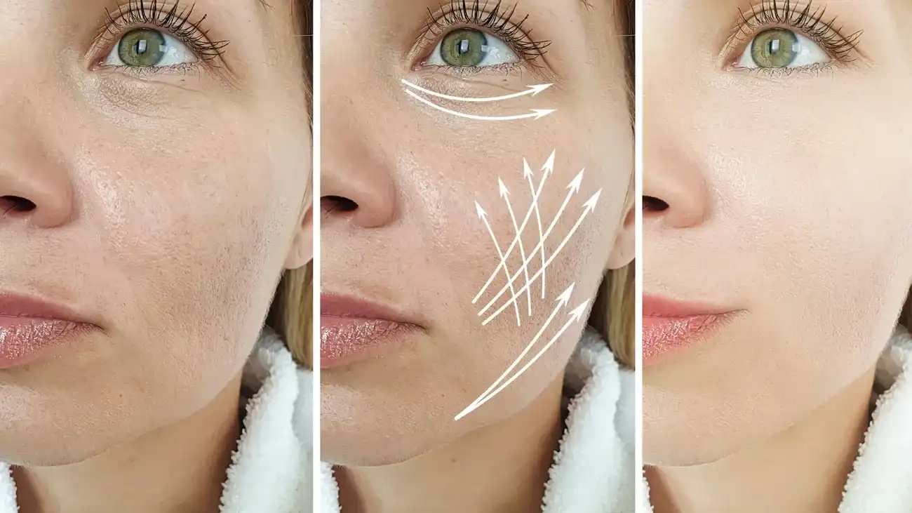 Can One Treatment Really Tackle More Than One Skin Concern Stoke upon Trent?