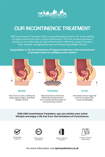 image to show how EMS treatment works for female urinary incontinence Stoke upon Trent